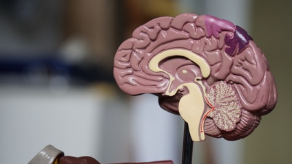 Product image for Care of Stroke Patients C1023 |  10 Hrs.