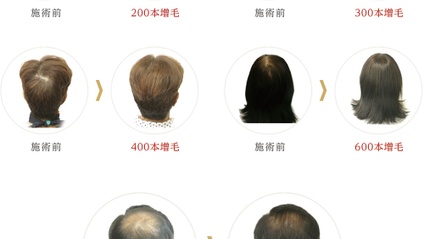 Product image for FELMO日本織髮課程