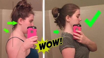 Product image for Correcting Forward Head Posture: Relieve Pain and Headaches