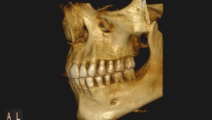 Product image for Formation Cone Beam (CBCT) • Omnipratique, Chirurgie Orale et Médecine Bucco-dentaire