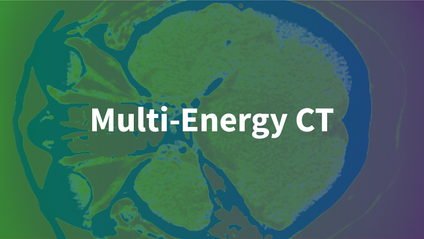 Product image for Multi-Energy CT