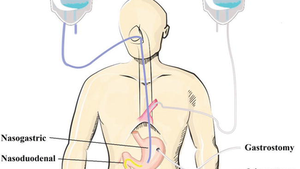 Product image for Nutrition Support Bundle for the RD Exam: Tube Feeding and TPN