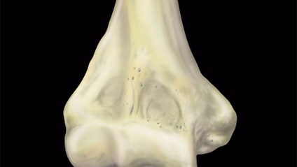 Product image for MRI Mastery Series: Elbow