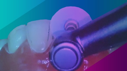 Product image for Practical Tips Utilizing Composite Resin in the Everyday Practice - Virtual Course