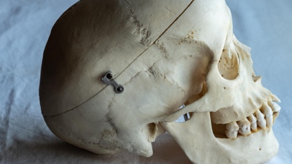Product image for Managing TMD & Other Orofacial Pains, A Modern Physiotherapy Perspective