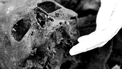 Product image for Forensic Analysis of Human Dentition