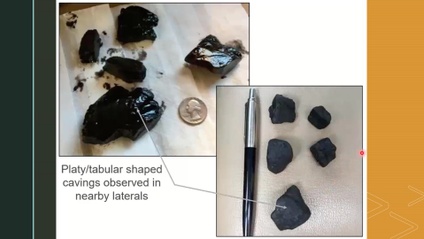 Product image for Conclusive Proof of Weak Bedding Planes in the Marcellus Shale and Proposed Mitigation Strategies