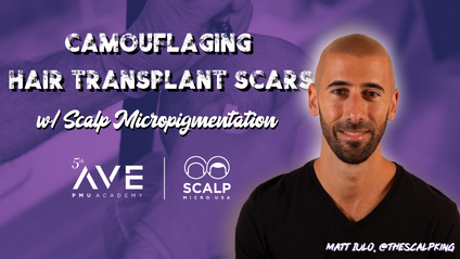 Product image for Camouflaging Hair Transplant Scars with Scalp Micropigmentation