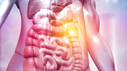 Product image for Diverticular Disease: New Concepts in its Pathophysiology and Treatment