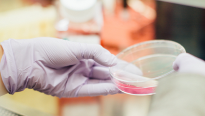 Product image for Herpes Simplex Virus Mini-Course - Coming Soon!