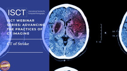 Product image for ISCT Presents Webinar Series: CT of Stroke