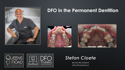 Product image for Course 5 : DFO in the Permanent Dentition