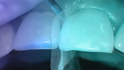 Product image for Transitional Bonding - Virtual Course