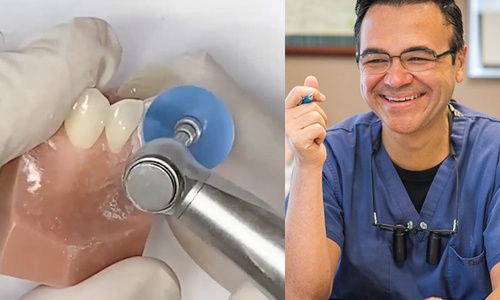 Product image for Become a Cosmetic Dentist with Composite Resin Veneers