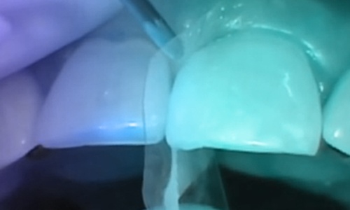 Product image for Transitional Bonding - Virtual Course