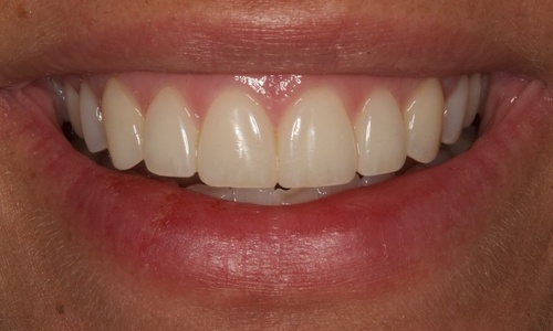 Product image for An Invitation to Think Differently About Composite Resin