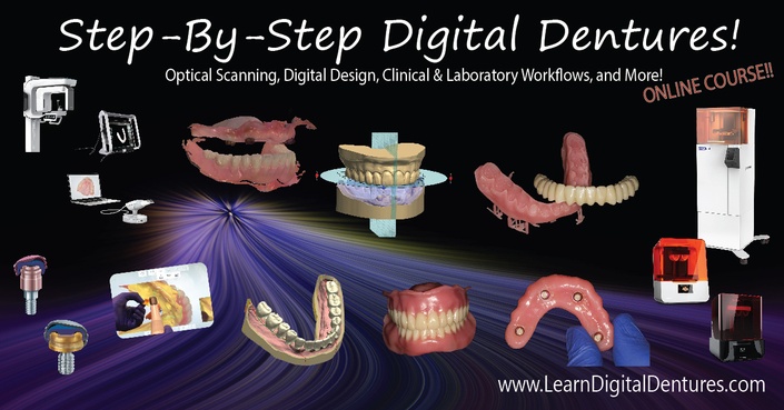 Fast Track Digital Dentures | Fast Track Dental CE