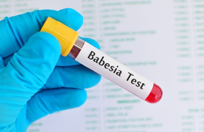 An Introduction to Human Babesiosis