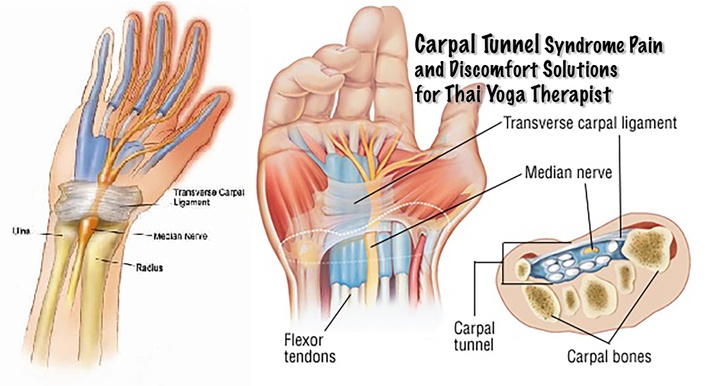 Acupuncture for Carpal Tunnel Syndrome - Pain Relief in Bangkok