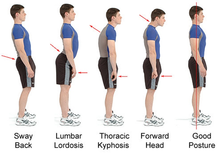 Postural Realignment Method