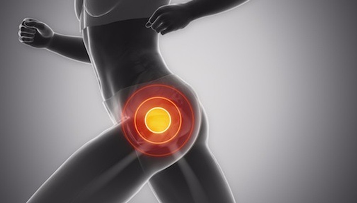 Hip Bursitis / Tendonitis — Empower