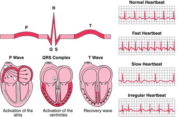 Basic Ekg Interpretation Brilliant Online Education